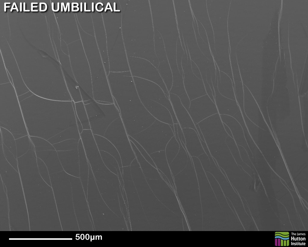 Failed umbilical liner